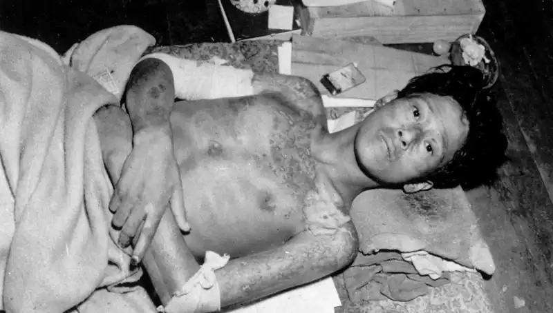 Nagasaki 80 Yıl Sonra Uyarıyor: Nükleer Felaketin Eşiğinde Miyiz?