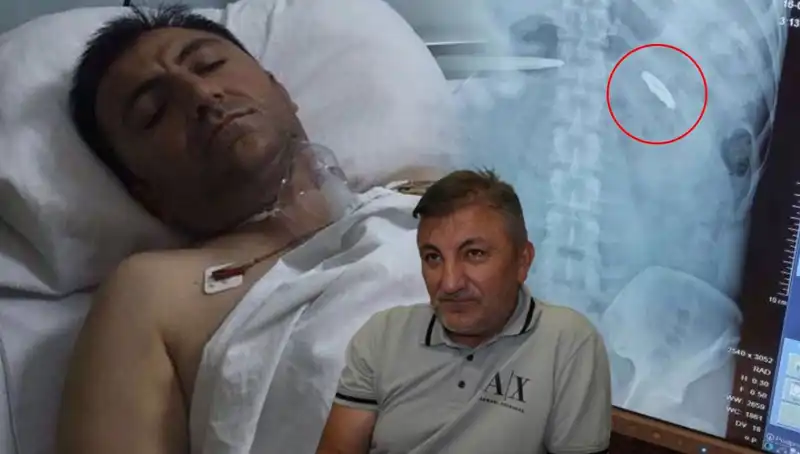 15 Temmuz’un Gölgesindeki Acı: Vücudundaki Kurşunla 9 Yıl Savaşan Kahraman